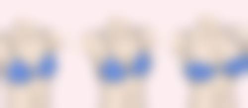 保妥适除皱的成效体现在哪些方面