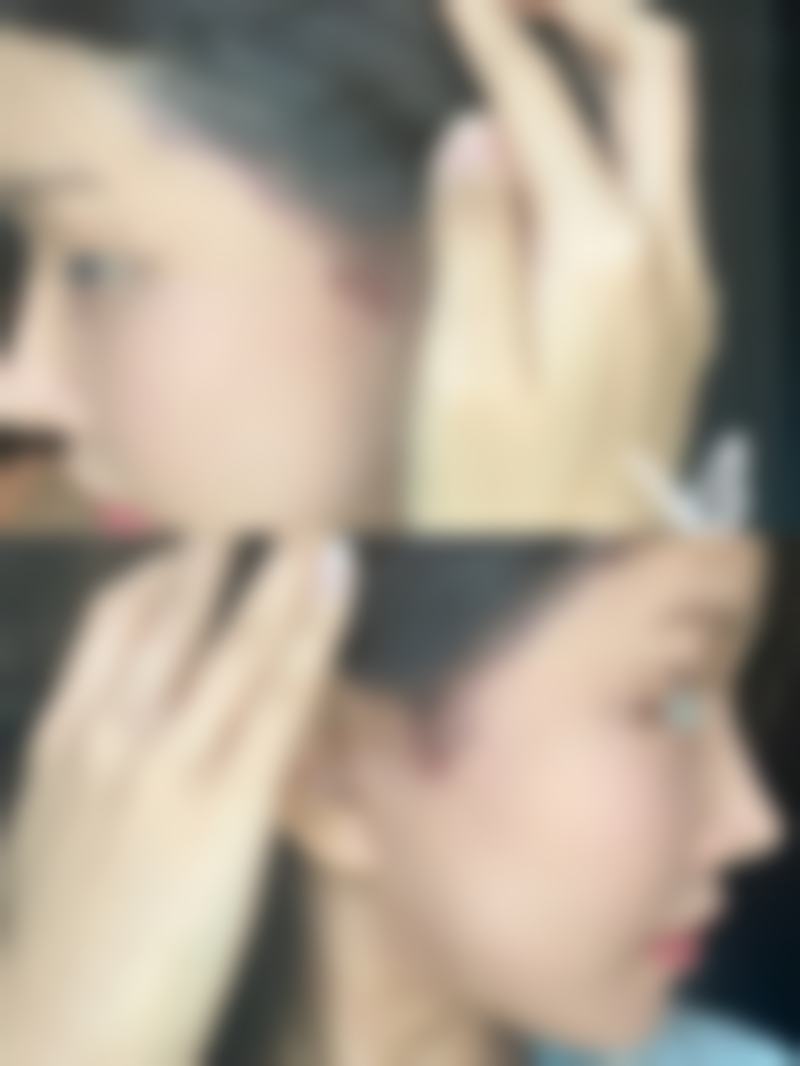 穿塑身衣可固定皮肤脂肪层