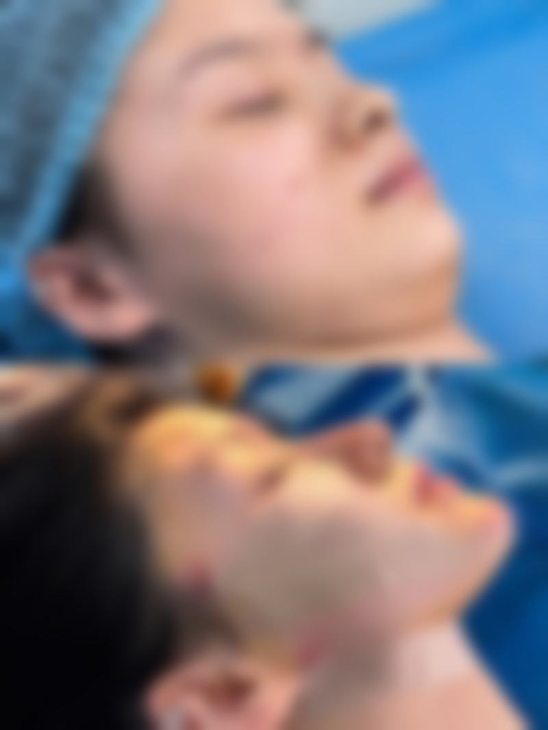 八、北京丽扬医疗美容诊所用户真实实例