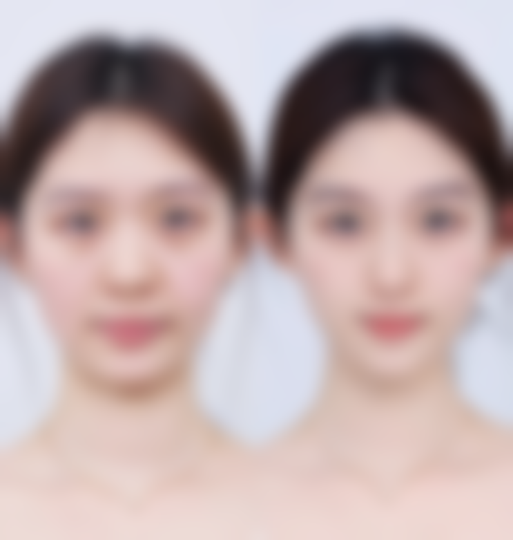 日本直江美丽私密整形医院口碑如何?