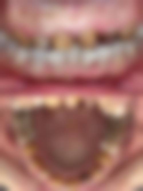 七、遂昌佳洁口腔诊所价格表:(仅供参考)