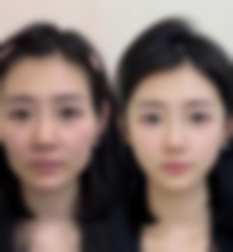 河源曙光植发医生简介