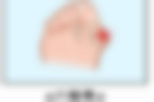 点阵激光对凹陷疤痕有成效吗
