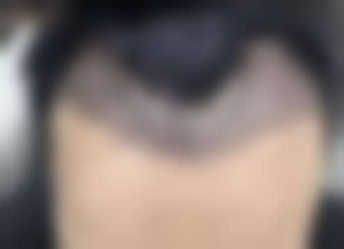 总结——惠州广肤门诊部怎么样？