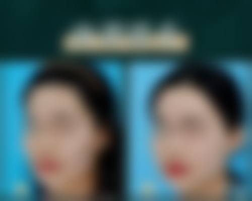 广州高尚栾翰林医生的麻醉实力有多硬核?