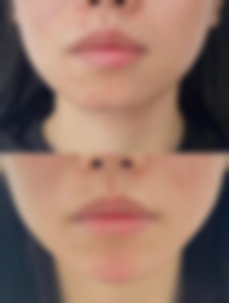 长沙致美医疗美容门诊部收费标准参考