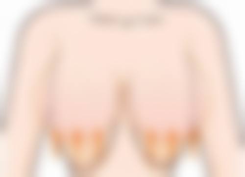 眼袋疼怎么办快速缓解？查明原因用热敷冷敷、调作息、按摩或用药试试