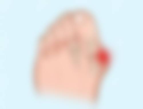 珠海馨悦医疗美容诊所邱会银医生技术好不好？