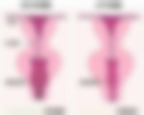 AGA皮肤科 浜松医院技术好不好？