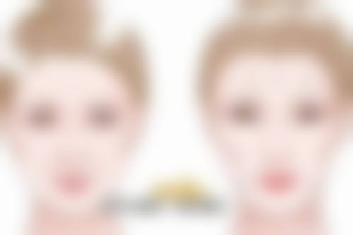 全切双眼皮不同情况下重新做的时间
