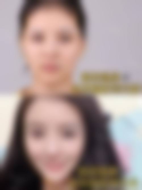 六、南宁伊丽莎白整形美容医院怎么预约：