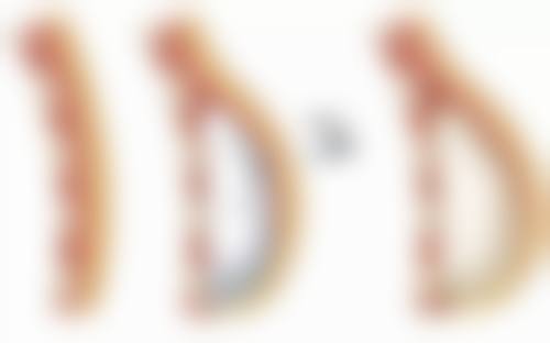 药物治疗消眼袋是否靠谱