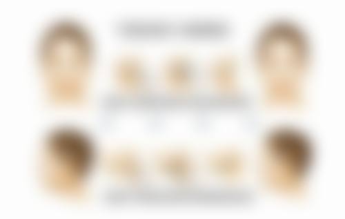 吸脂肚子有哪些优缺点