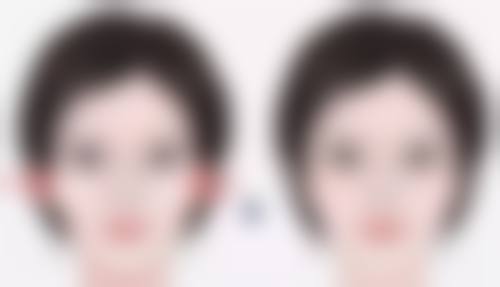 韩国蓓拉假体的性价比