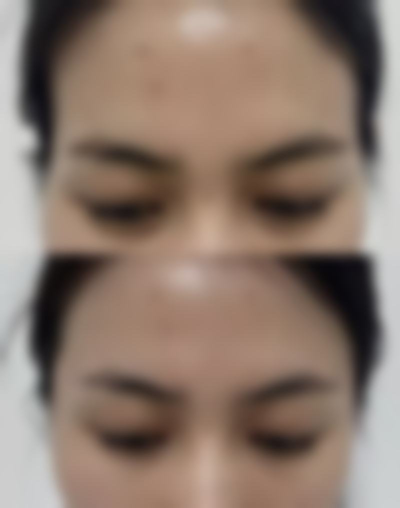 总结——榆林榆爱悦己医疗美容诊所怎么样？