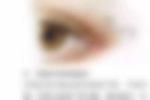 长沙爱思特整形割双眼皮情况