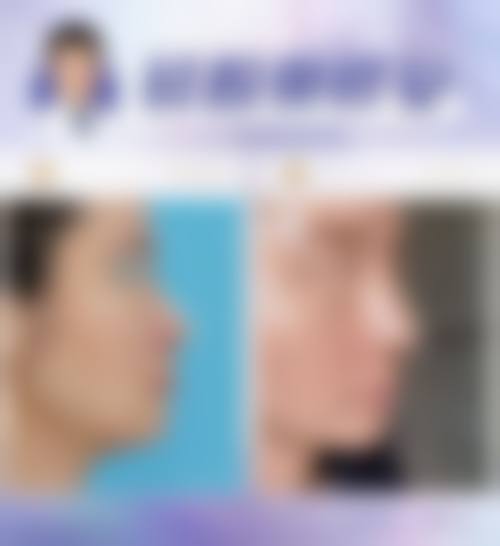 广东省黄金龙和李春明怎么选？广州高尚医美眼部/鼻部等专长医生优势对比速定变美方案！ 