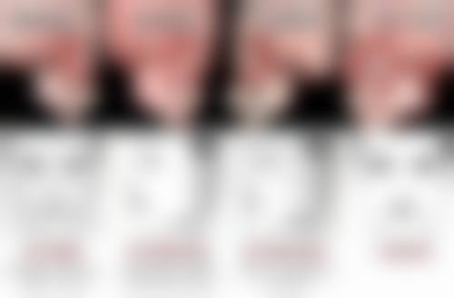 叶城县系之美整形医院收费标准参考