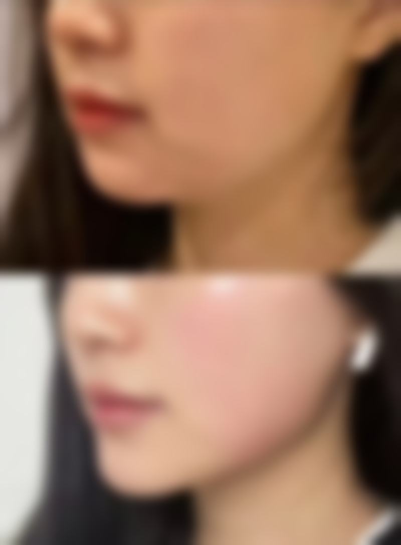 叶城县系之美整形医院营业时间