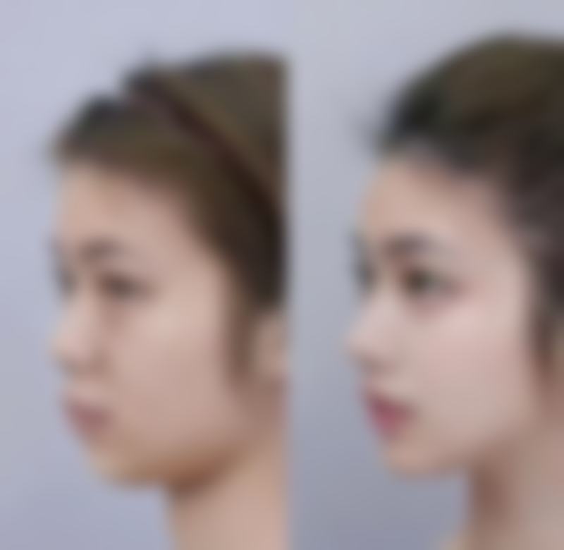 叶城县系之美整形医院口碑如何?