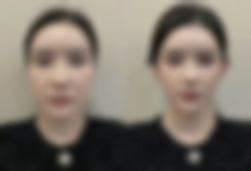 七、盘锦馥安整形医院价格表:(仅供参考)