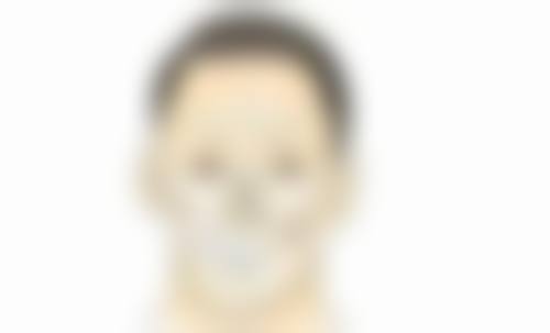 面对双眼皮变单眼皮该如何应对