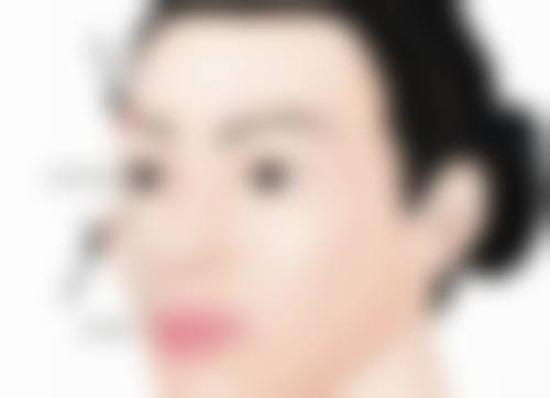 眼皮抽脂有什么副作用？感染、凹陷、不对称等问题你都了解吗
