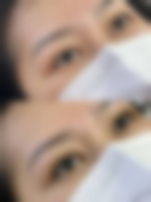 五、南润贞医生擅长项目有哪些