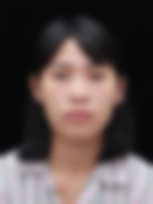 八、南润贞医生医美费用一览表