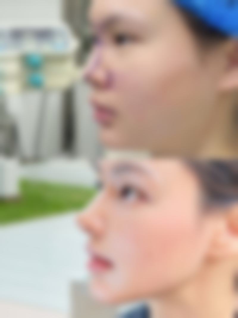 术后护理不当影响消肿