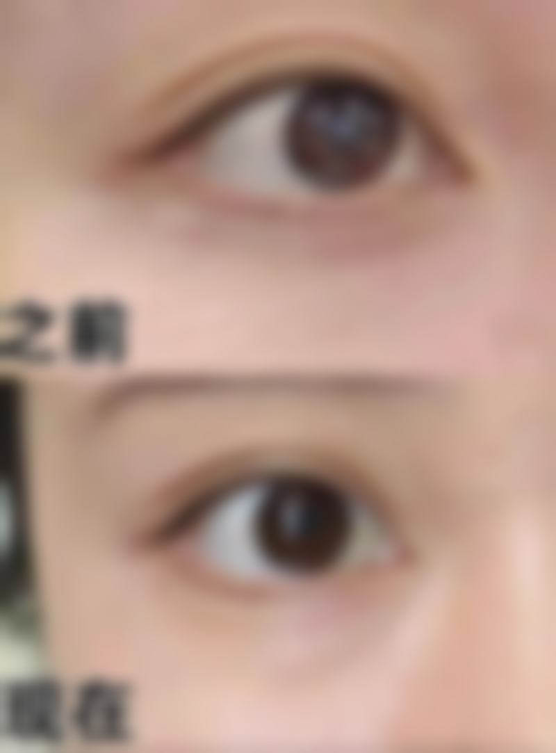 广州南方燕岭医院整形美容地址
