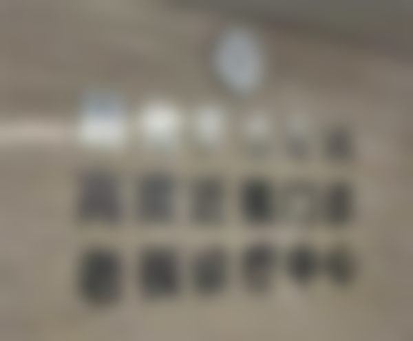 成都新视界眼科医院近视手术术前检查有哪些项目？快来了解