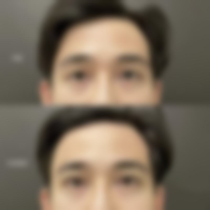 八、南昌甄美医疗美容医院用户真实实例