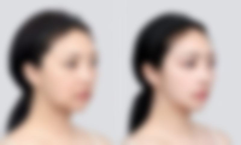 成都高新置美归璞医疗美容诊所医院技术好不好？