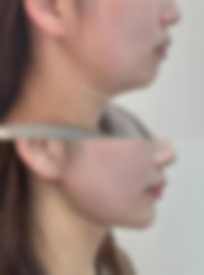 总结——恩施利川仁爱医学美容门诊部怎么样?