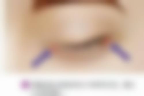 江门玛丽整形美容门诊部硬件设备精良!