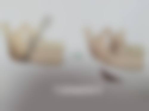 纳米无痕双眼皮手术的缺点