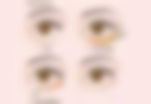 深圳康盈整形门诊部医院技术好不好?