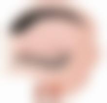 如何预防双眼皮长皱纹
