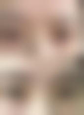 总结——南宁熹润医疗美容诊所怎么样？