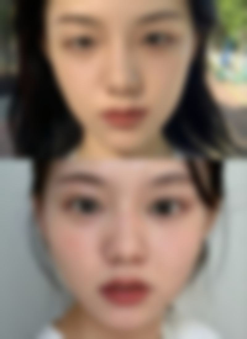 八、保定市北市区雷胜辉医疗美容整形外科诊所用户真实实例