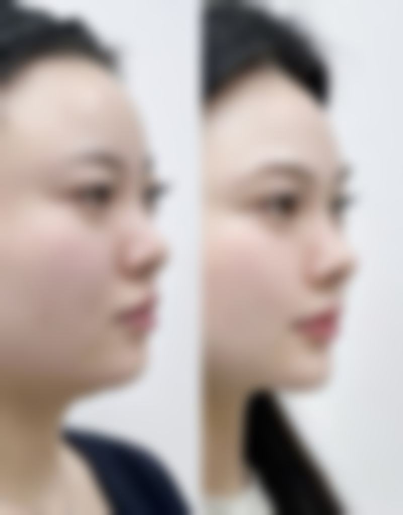 总结——朵戈芙蒂医院明洞店怎么样?