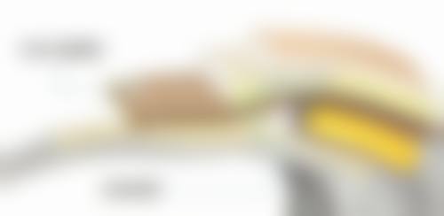 抽脂后短期可能出现的问题
