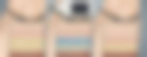 隆胸和假体哪个好？常见隆胸方式对比、差异及适合人群全解析