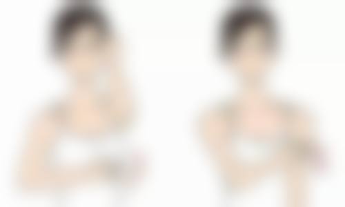 韩式三点双眼皮与其他双眼皮手术的原理对比