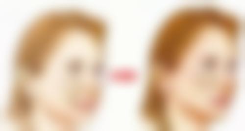 普洱悦她婕熹卡医疗美容诊所硬件设备精良！