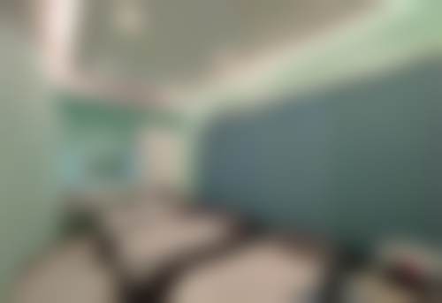 中山爱思特陈伟彬做双眼皮咋样？单眼皮告别贴双眼皮贴烦恼