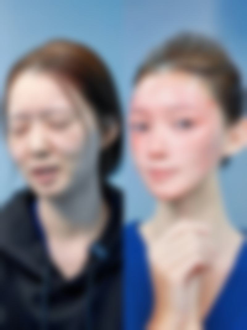 韩国TheOne综合整形医院收费标准参考
