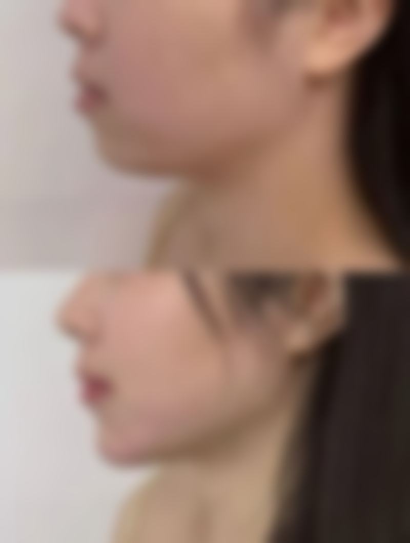 总结——西安光仁医院爱斯丁整形中 心怎么样？