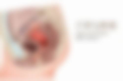 如何降低手术风险